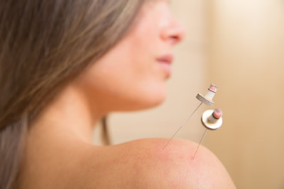 moxibustion or moxa treatment