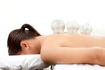 Cupping - ancient Chinese medicine treatment